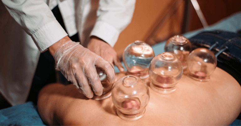Does The Rock’s ‘cupping’ treatment really work? We asked an expert Does The Rock’s ‘cupping’ treatment really work? We asked an expert