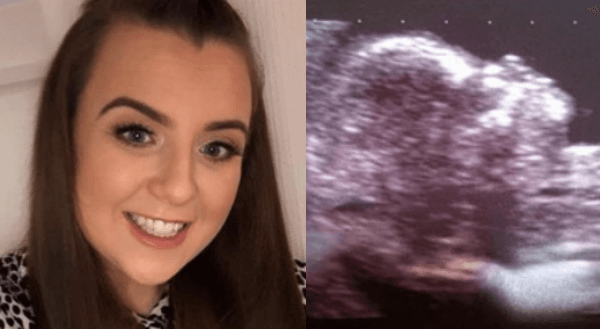 Virgin shocked to discover she’s pregnant Virgin shocked to discover she’s pregnant