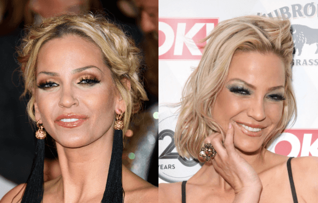 Sarah Harding’s ‘tumours shrink’ after cancer treatment Sarah Harding’s ‘tumours shrink’ after cancer treatment