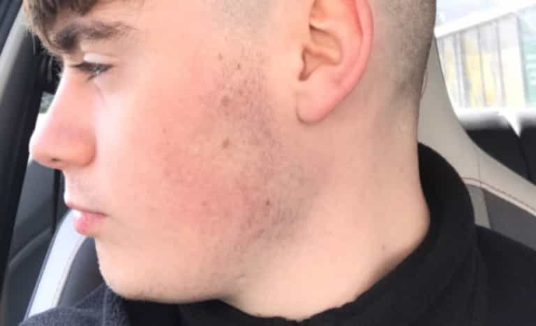 Guy left with ‘botched’ haircut after waiting four months for barbers to reopen Guy left with ‘botched’ haircut after waiting four months for barbers to reopen