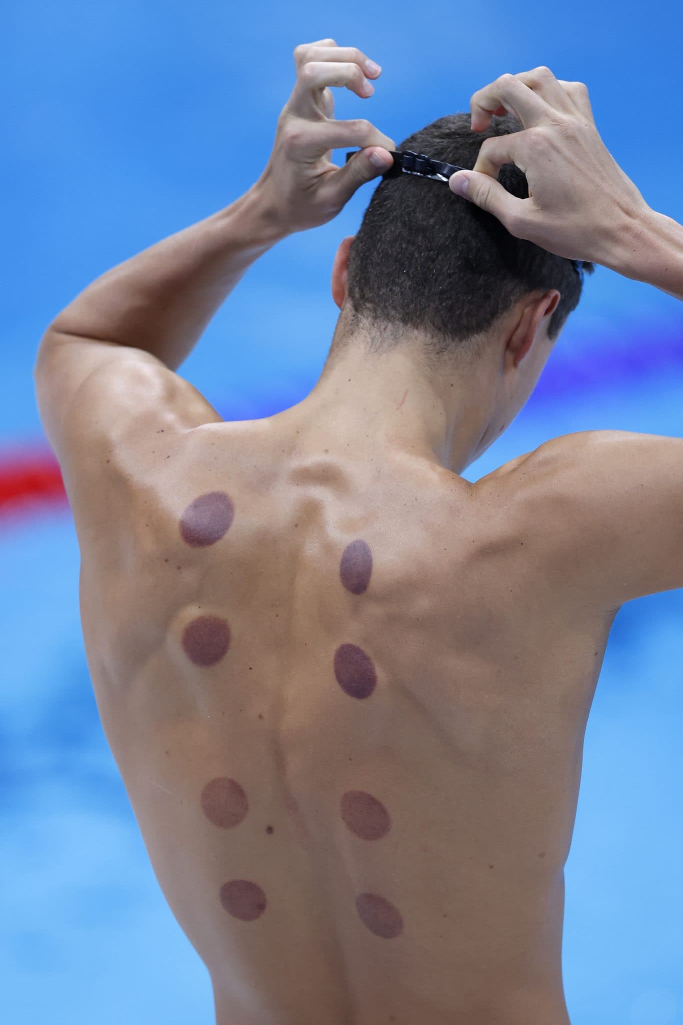 What are the dark circles on swimmers’ backs at Paris Olympics