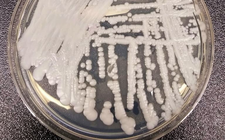 Deadly drug-resistant fungus spreading in America Deadly drug-resistant fungus spreading in America