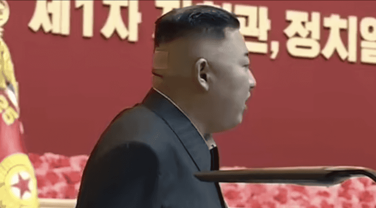 Kim-Jong un spotted with plasters and mystery spots on back of head amid health rumours Kim-Jong un spotted with plasters and mystery spots on back of head amid health rumours