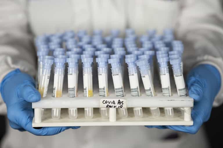 WHO monitoring new Covid variant named Mu WHO monitoring new Covid variant named Mu