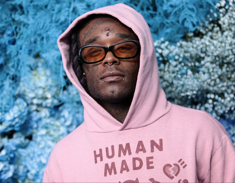 Lil Uzi Vert’s £17.4 million forehead diamond has been ripped from his forehead Lil Uzi Vert’s £17.4 million forehead diamond has been ripped from his forehead