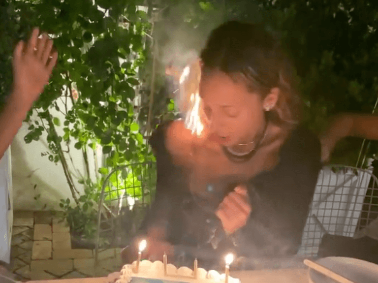 Nicole Richie lights hair on fire during birthday dinner Nicole Richie lights hair on fire during birthday dinner