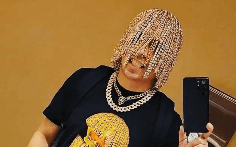 Rapper gets gold chains surgically implanted into his head as ‘hair’ Rapper gets gold chains surgically implanted into his head as ‘hair’