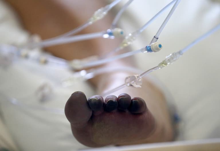 Study reveals why some people get ‘Covid toe’ Study reveals why some people get ‘Covid toe’