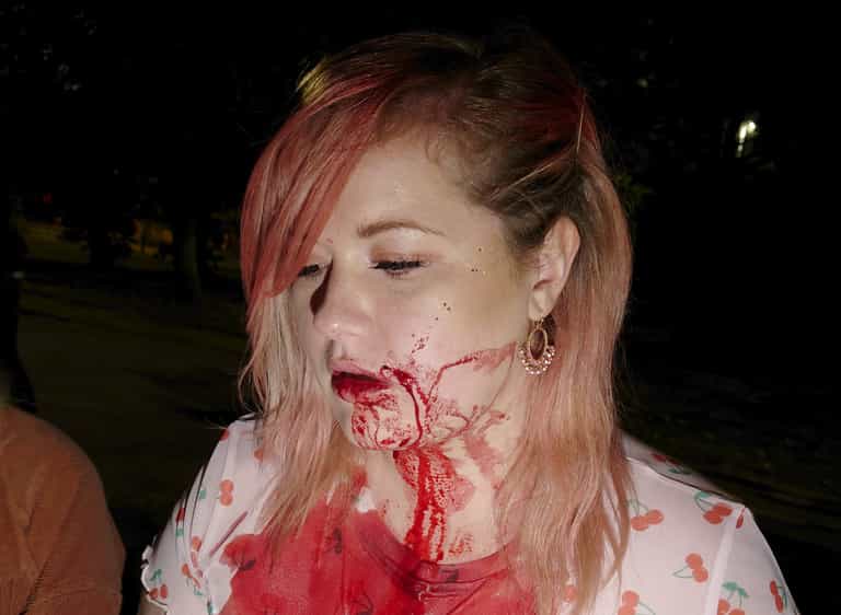 Horrific pictures show what happened after woman defends man ‘attacked for being gay’ Horrific pictures show what happened after woman defends man ‘attacked for being gay’