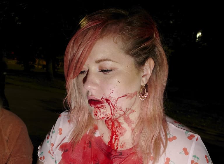 Horrific pictures show what happened after woman defends man ‘attacked for being gay’ Horrific pictures show what happened after woman defends man ‘attacked for being gay’