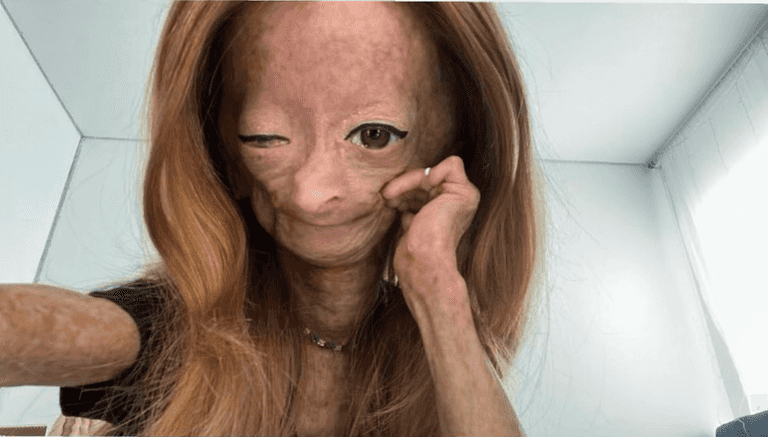YouTube star Adalia Rose Williams dies aged just 15 YouTube star Adalia Rose Williams dies aged just 15