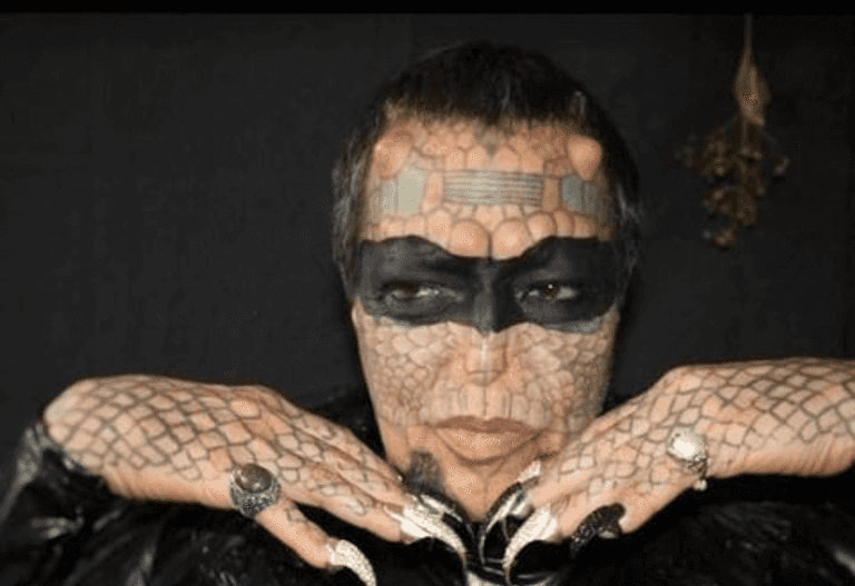 Former banker becomes ‘genderless reptile’ after castration procedure Former banker becomes ‘genderless reptile’ after castration procedure