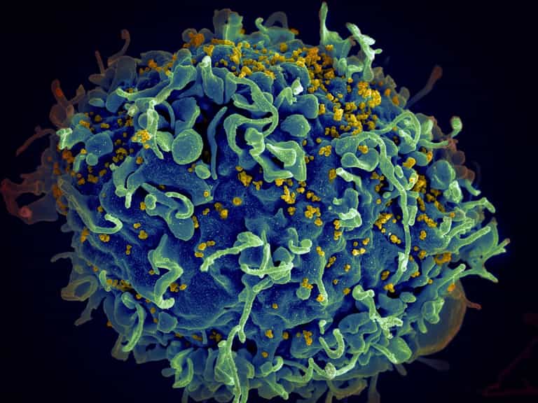 Woman is cured of HIV for first time ever in ‘scientifically important’ breakthrough Woman is cured of HIV for first time ever in ‘scientifically important’ breakthrough