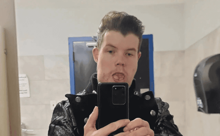 Man born with rare condition forced to pick between his face or voice Man born with rare condition forced to pick between his face or voice