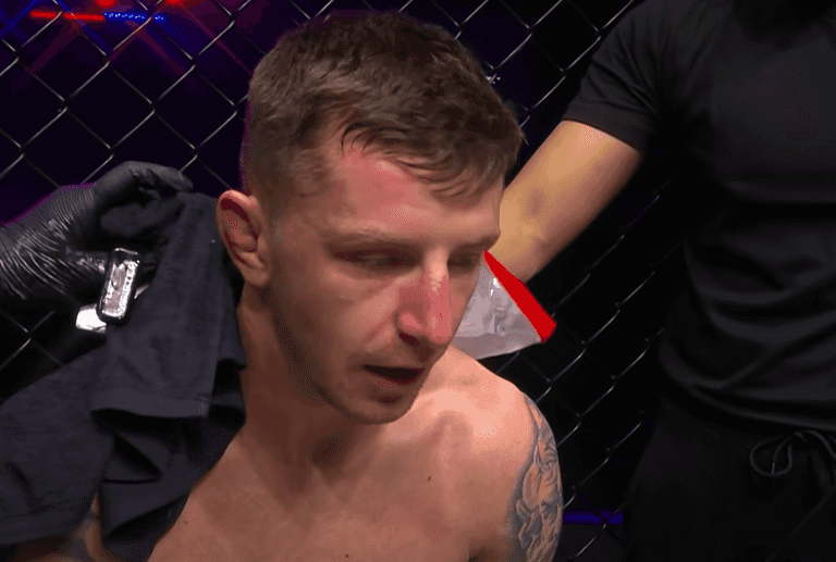 Cage fighter launched brutal hammer attack on thief who tried to raid his home Cage fighter launched brutal hammer attack on thief who tried to raid his home