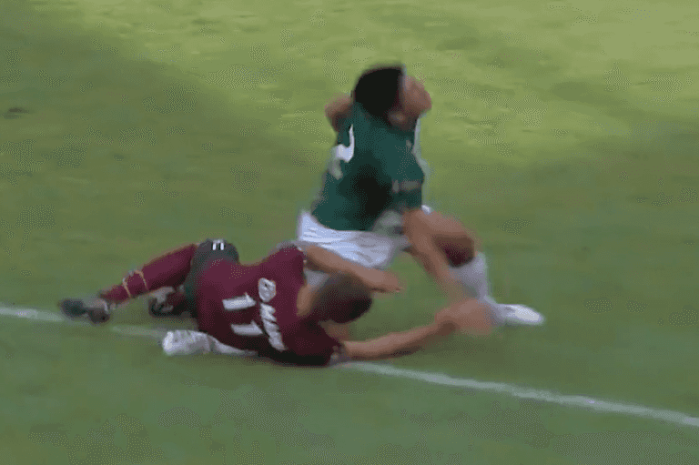 Player sent off after being hit in the face and breaking opponent’s leg during fall Player sent off after being hit in the face and breaking opponent’s leg during fall