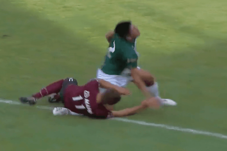 Player sent off after being hit in the face and breaking opponent’s leg during fall Player sent off after being hit in the face and breaking opponent’s leg during fall