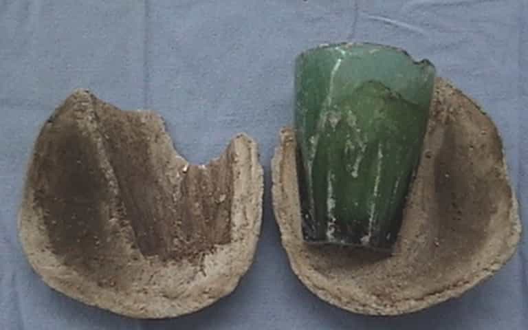Woman’s UTI turns out to be glass tumbler inserted four years ago for ‘erotic purposes’ Woman’s UTI turns out to be glass tumbler inserted four years ago for ‘erotic purposes’