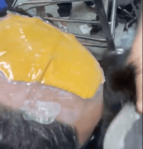 Video shows how man hid $40k worth of gold under his toupee Video shows how man hid $40k worth of gold under his toupee