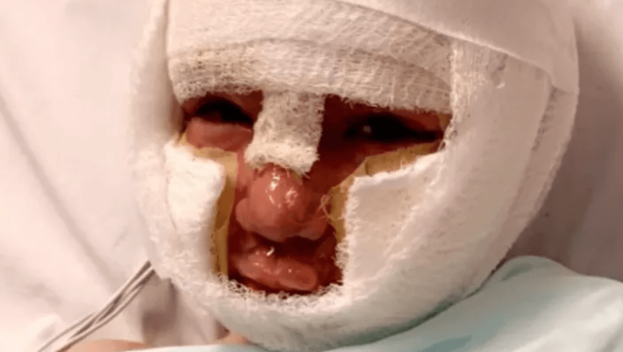 Schoolboy set on fire by bully with petrol soaked tennis ball ‘scarred for life’