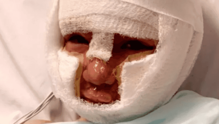 Schoolboy set on fire by bully with petrol soaked tennis ball ‘scarred for life’ Schoolboy set on fire by bully with petrol soaked tennis ball ‘scarred for life’