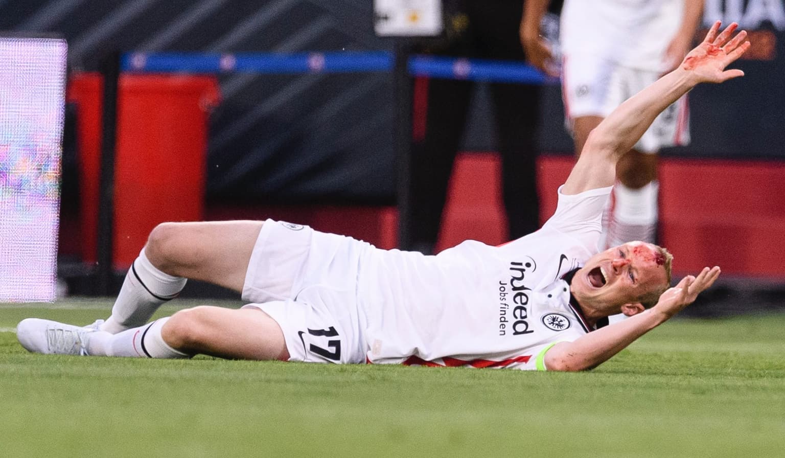 Sebastian Rode shows off battle scar from Lundstram challenge in Europa League final
