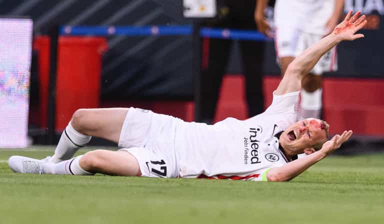 Sebastian Rode shows off battle scar from Lundstram challenge in Europa League final Sebastian Rode shows off battle scar from Lundstram challenge in Europa League final