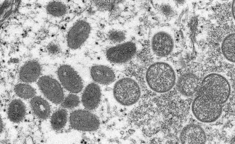 Monkeypox contacts advised to isolate for 21 days, UKHSA says Monkeypox contacts advised to isolate for 21 days, UKHSA says
