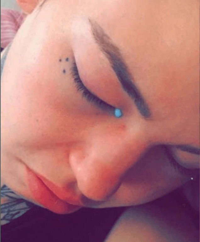 Woman goes blind and cries blue tears after having eyeballs tattooed