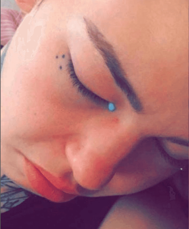 Woman goes blind and cries blue tears after having eyeballs tattooed Woman goes blind and cries blue tears after having eyeballs tattooed