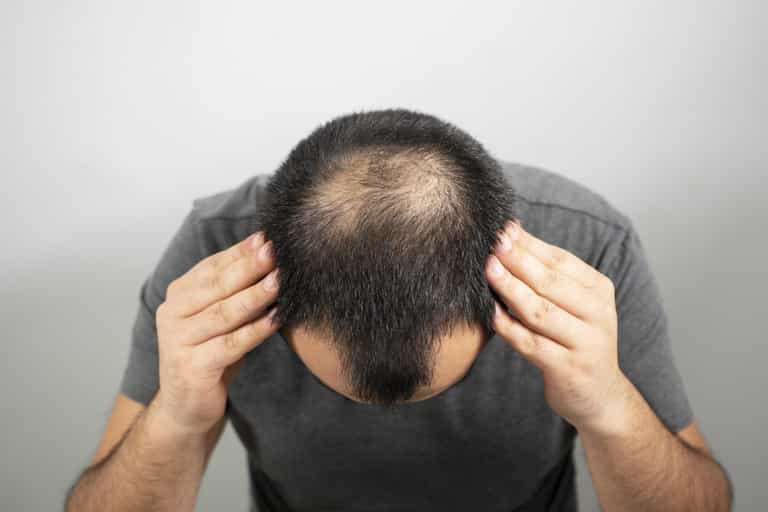 Great news for bald men as new drug successfully regrows hair in 40% of patients Great news for bald men as new drug successfully regrows hair in 40% of patients