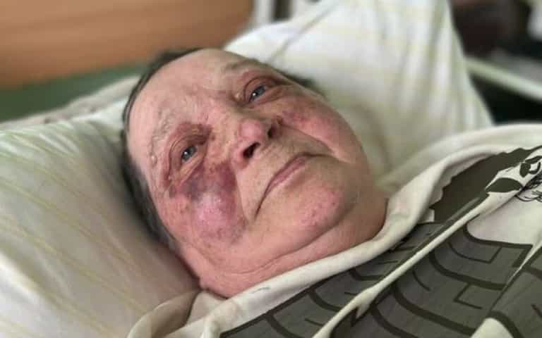 Woman, 70, ‘viciously beaten’ at Russian checkpoint after refusing to give up passport, Ukraine claims Woman, 70, ‘viciously beaten’ at Russian checkpoint after refusing to give up passport, Ukraine claims