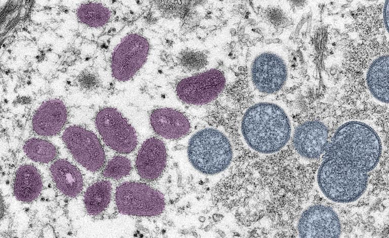 Gay and bisexual men to be offered monkeypox vaccine Gay and bisexual men to be offered monkeypox vaccine