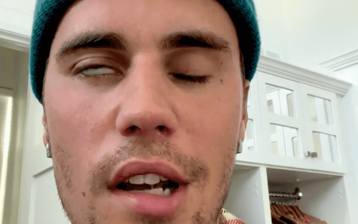 Justin Bieber postpones tour after illness leaves his face partially paralysed Justin Bieber postpones tour after illness leaves his face partially paralysed