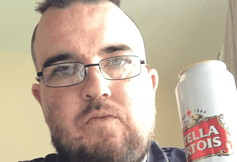 Man gets full sized Stella tattoo on his head because he loves the drink that much Man gets full sized Stella tattoo on his head because he loves the drink that much