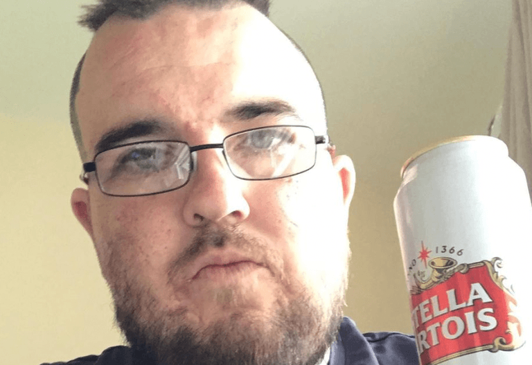 Man gets full sized Stella tattoo on his head because he loves the drink that much Man gets full sized Stella tattoo on his head because he loves the drink that much