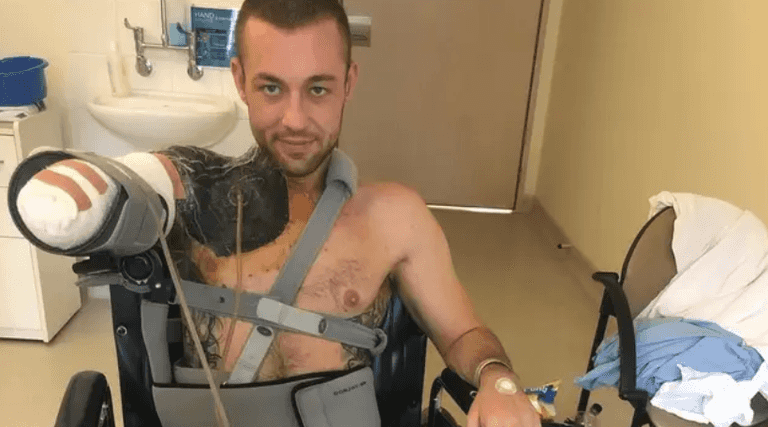 Man wakes up from coma to find he’s lost his arm after gym injury turned into ‘flesh eating’ infection Man wakes up from coma to find he’s lost his arm after gym injury turned into ‘flesh eating’ infection