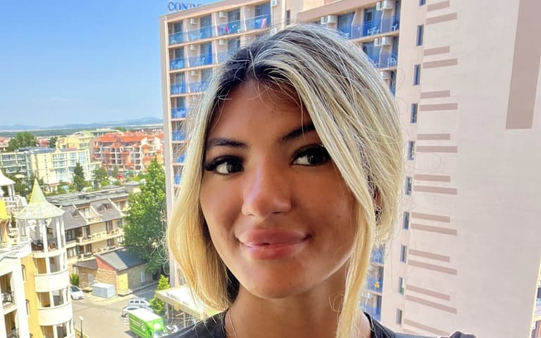 Woman ends up with ‘plastic’ forehead after falling asleep in the sun for 30 mins Woman ends up with ‘plastic’ forehead after falling asleep in the sun for 30 mins