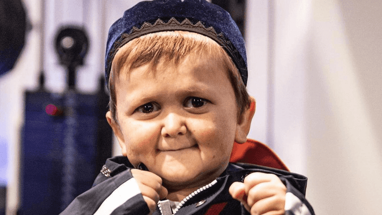 Hasbulla’s condition explained as people still confused about how old he is Hasbulla’s condition explained as people still confused about how old he is