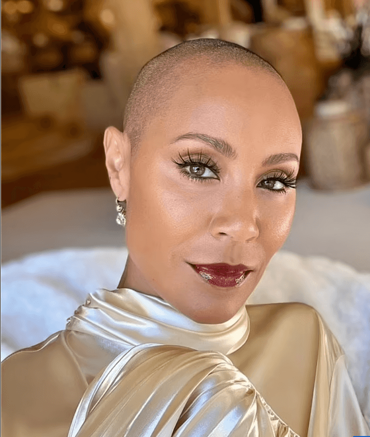 Jada Pinkett Smith celebrates “Bald Is Beautiful Day’ months after Chris Rock’s Oscars joke Jada Pinkett Smith celebrates “Bald Is Beautiful Day’ months after Chris Rock’s Oscars joke