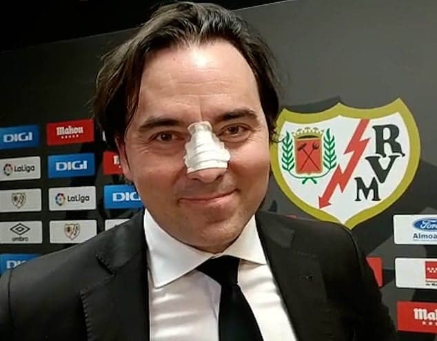 Rayo Vallecano president claims he was headbutted by player’s agent Rayo Vallecano president claims he was headbutted by player’s agent