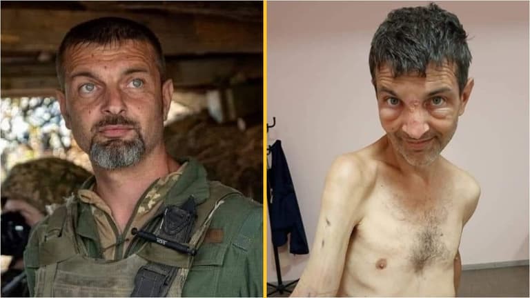 Ukraine prisoner of war shows shocking toll Russian captivity had on his body Ukraine prisoner of war shows shocking toll Russian captivity had on his body