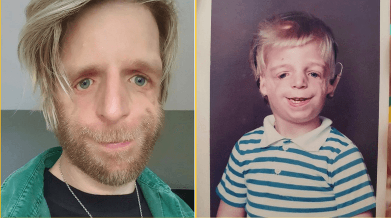 Man was abandoned at birth by parents because they didn’t like his face Man was abandoned at birth by parents because they didn’t like his face