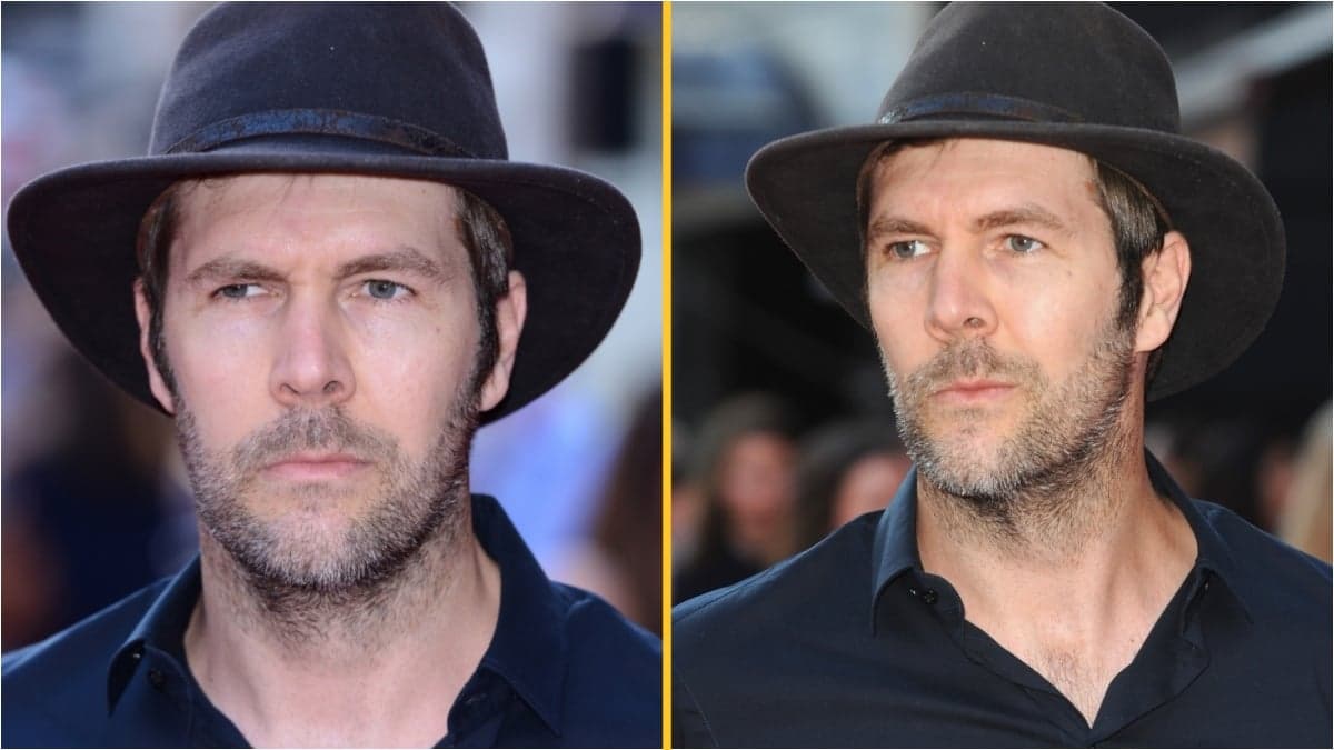 Comedian Rhod Gilbert shares that his cancer is stage 4