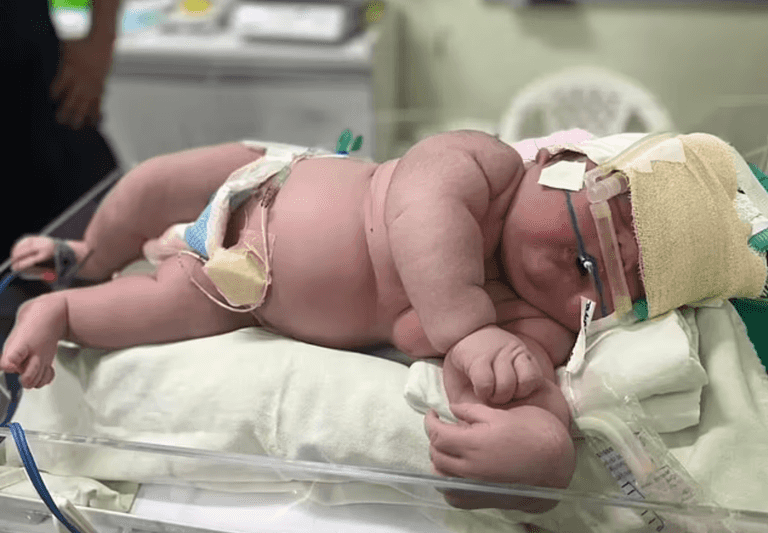 Mum gives birth to 2ft tall baby weighing a huge 16lbs Mum gives birth to 2ft tall baby weighing a huge 16lbs