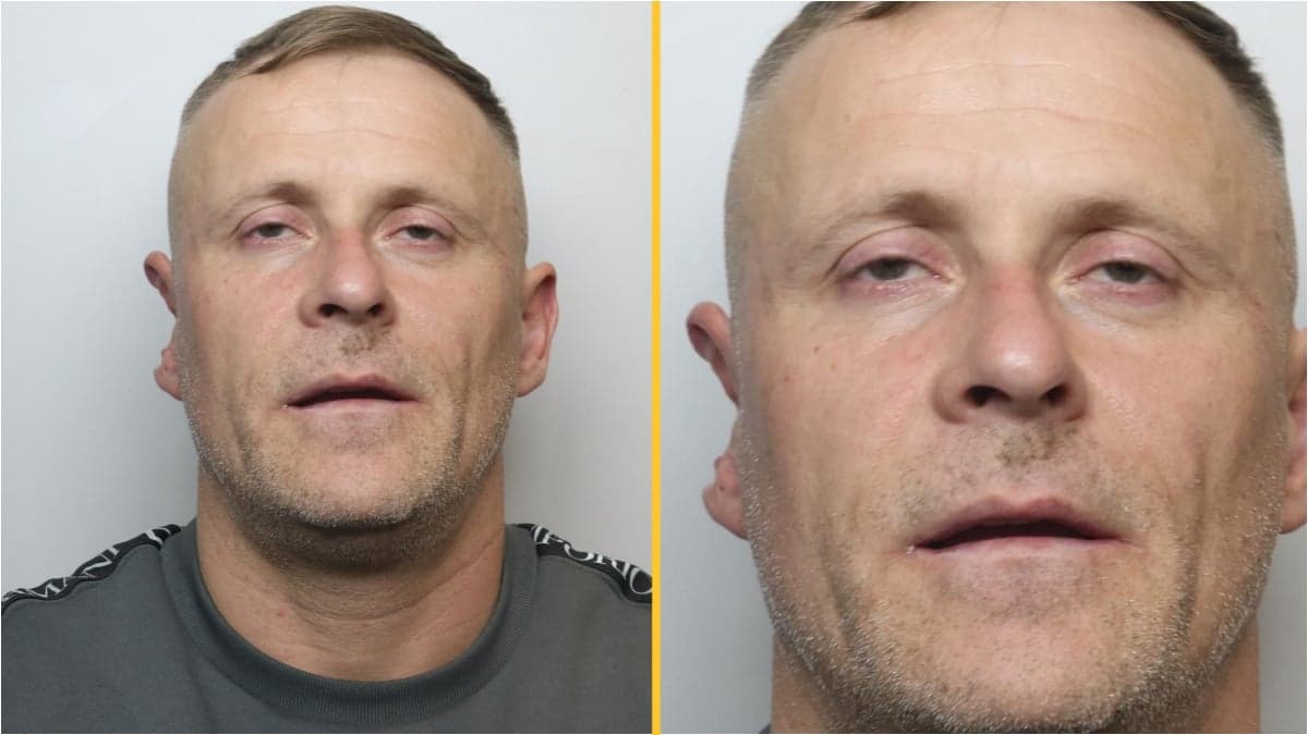 Police warn public not to approach man with half an ear