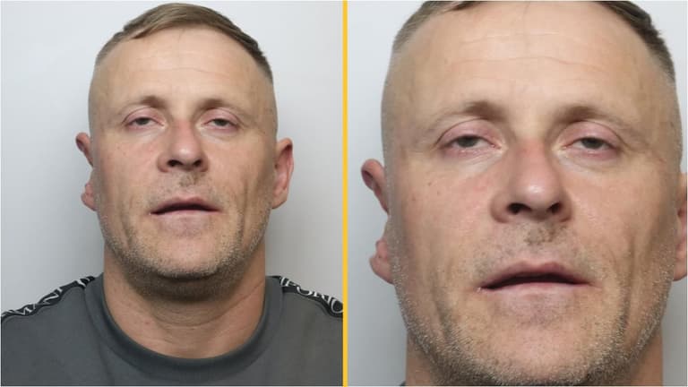 Police warn public not to approach man with half an ear Police warn public not to approach man with half an ear