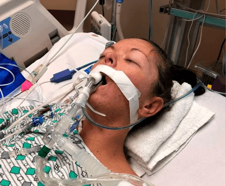 Vaping addict left on life support with deadly lung condition Vaping addict left on life support with deadly lung condition