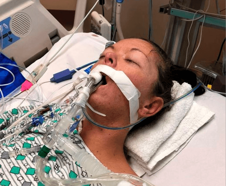 Vaping addict left on life support with deadly lung condition Vaping addict left on life support with deadly lung condition