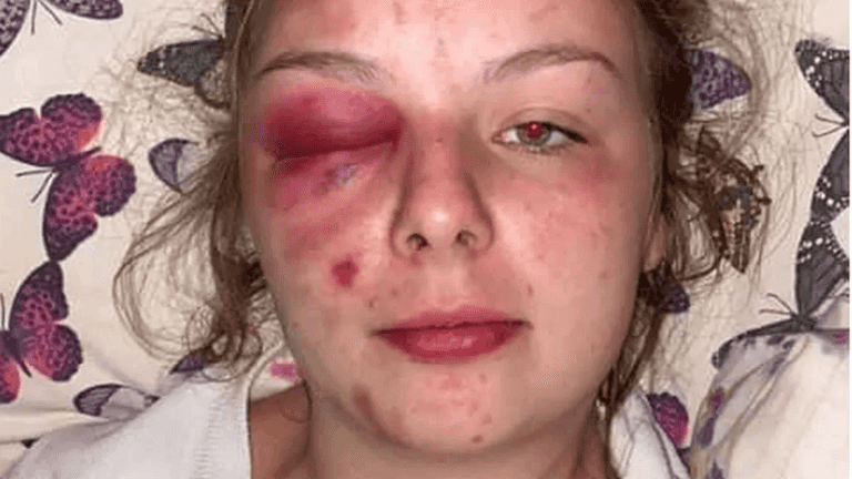 Eleanor Williams: Woman jailed over false rape claims Eleanor Williams: Woman jailed over false rape claims